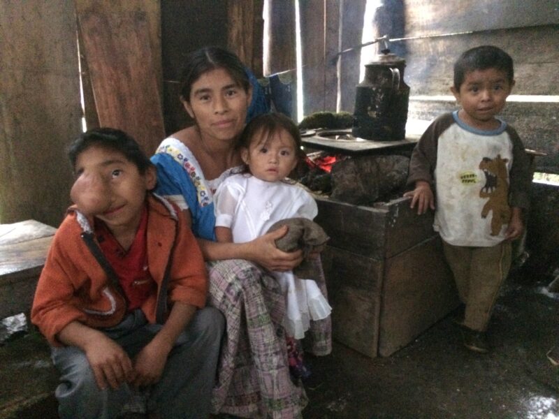 Daniel and his family sit around their old, unventilated stove.