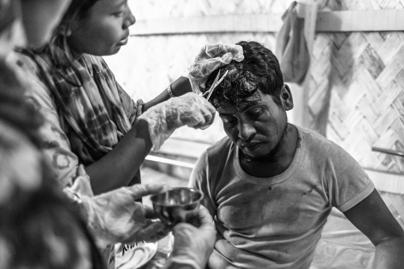 Abdu, a Rohingya refugee man, receiving head stitches and antiseptic from medical teams’ clinic