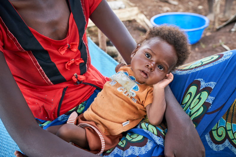 Christive, a refugee baby, suffering from malnutrition, malaria, pneumonia, and tuberculosis, being held by his mother