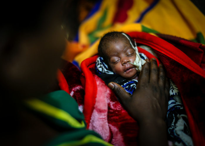 Premature baby born in Tanzania, 2019.