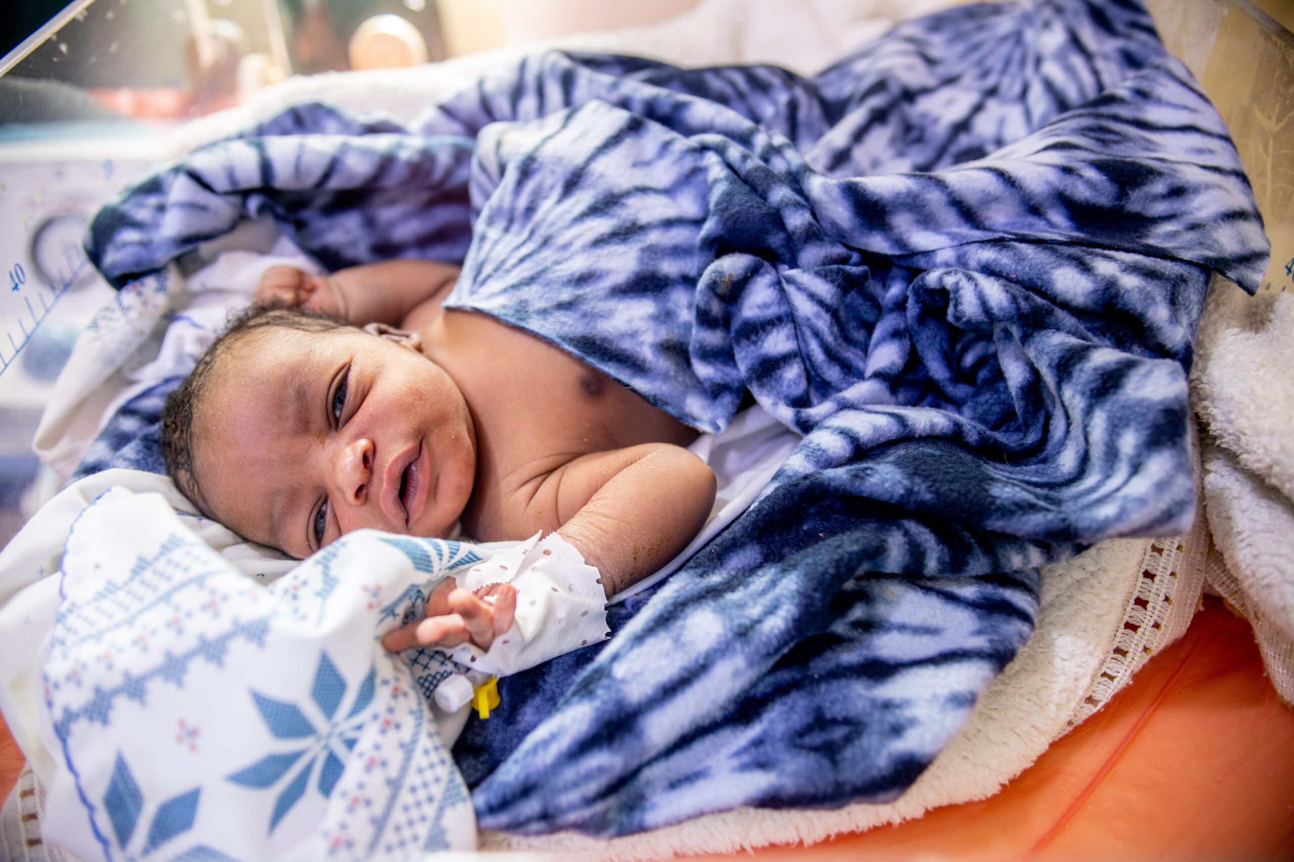 A newborn baby receives care in the NICU. 