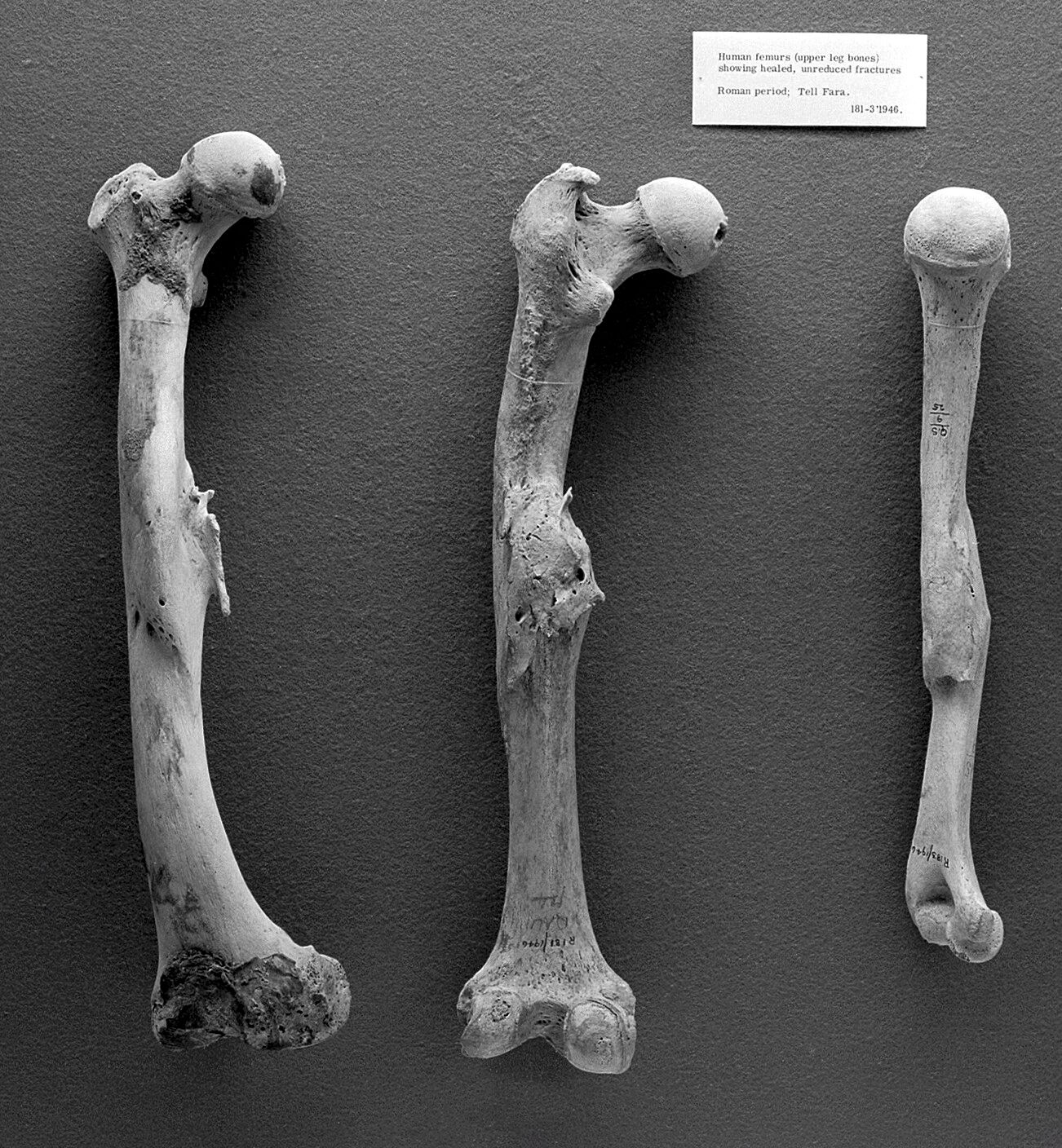 Human femurs and humerus (right) from Roman period 