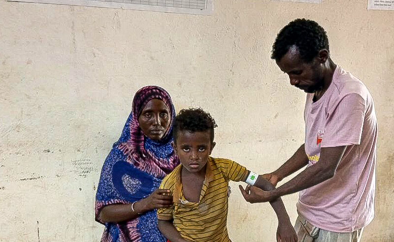 A volunteer measures a boy's MUAC with a tape.
