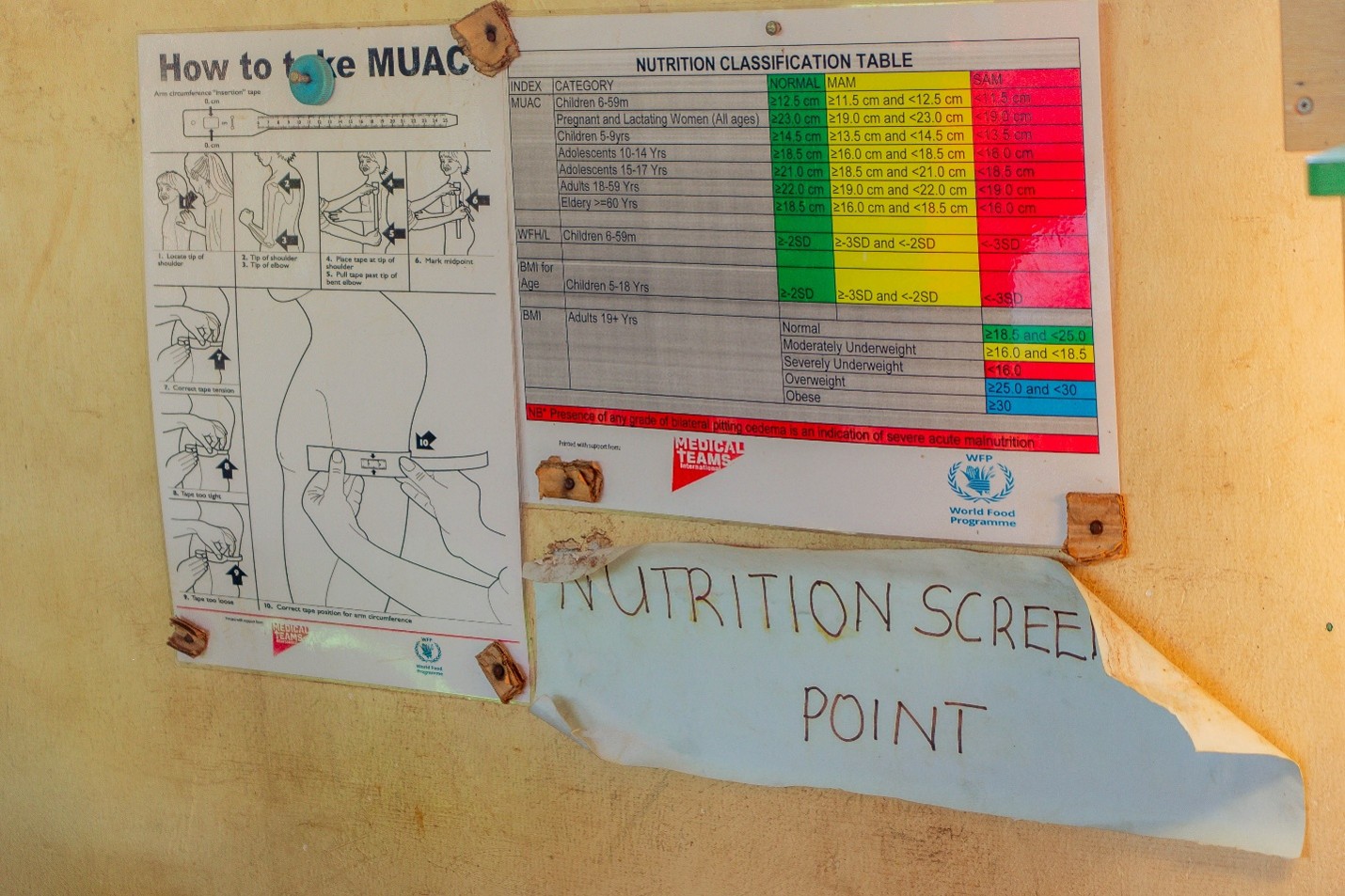 Illustrations of procedures on measuring and evaluating Mid-Upper Arm Circumference (MUAC)